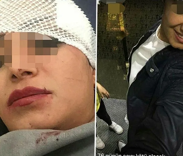 1643690976244.jpeg Jiletli dehşet! Arkadaşına kabusu yaşattı - 2