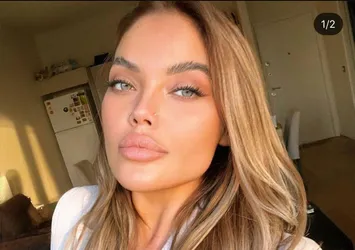 Ukraynalı model balkondan düşmüştü! Anzelika'nın son anları kamerada