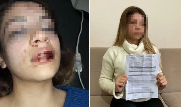 1669383267145.jpg Kocasının telefonunda 'babalık testi fiyatı' aramasını gördü! Çocuğunun yanında hamile kadını darbetti - 3