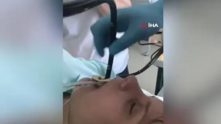Ağaç altında uyuya kalan kadına yılan şoku! 1 metreden uzun yılan ameliyatla ağzından böyle çıkarıldı