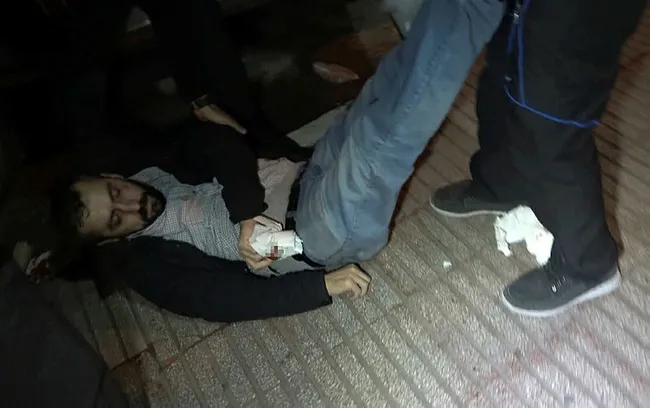 Bursa’da kısıtlamayı ihlal eden boksör gazetecinin burnunu kırdı - 2