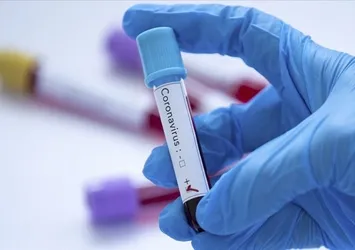 Covid-19 yeniden artışa mı geçti!? Uzmanlar açıkladı