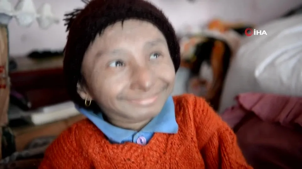 Dünyanın en kısa adamı hayatını kaybetti