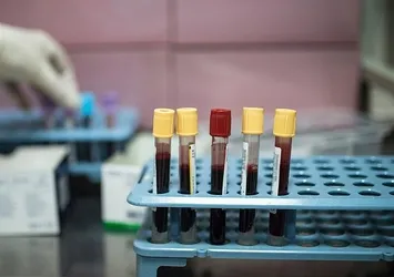 Türk bilim insanları kanserle savaşacak uyuyan hücrelerin şifrelerini keşfetti | Prof. Dr. Güneş Esendağlı'dan önemli açıklamalar