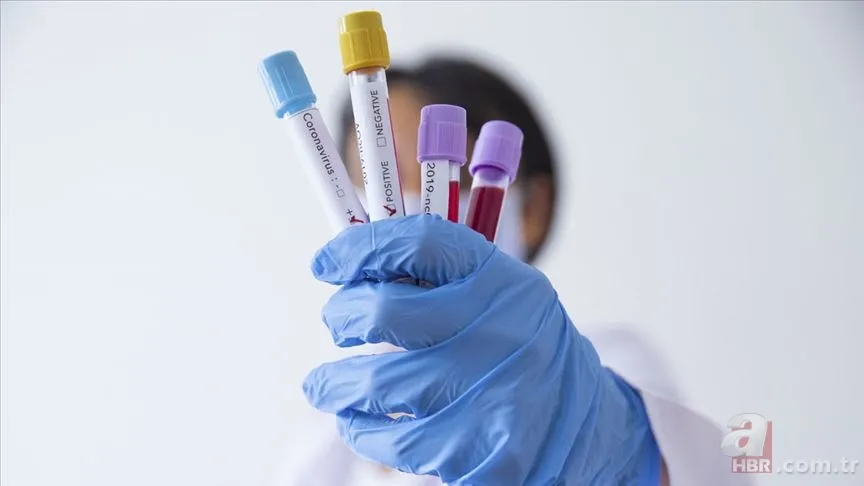 Remdesivir ve TR-C 19 ilacı nedir? Koronavirüs tedavisinde Remdesivir ve TR-C 19 etkili mi? 7