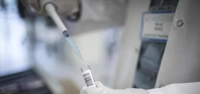 Koronavirüse karşı antikor testleri pazartesi başlayacak! Bilim Kurulu Üyesi  Seçil Özkan’dan kritik mesajlar