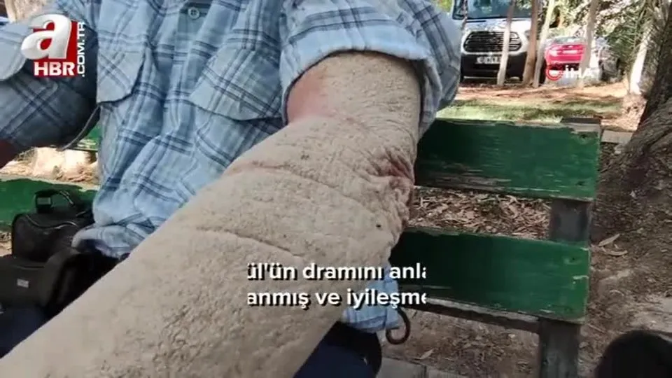 Hastalığına alıştı insanların kendisinden kaçmasına alışamadı