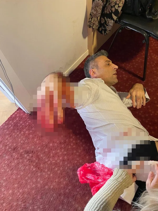 Yenilik Partisi Genel Başkanı Öztürk Yılmaz’a bıçaklı saldırı: Hastaneye kaldırıldı