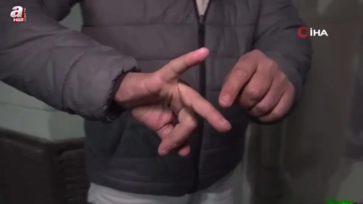 Balıkla dövüp çuprayla parmağını kırdılar