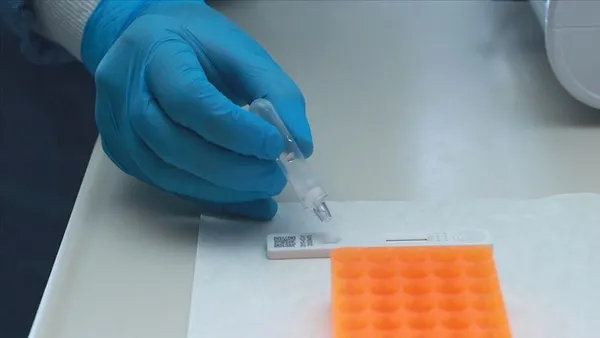 1649106074005.jpg PCR testi pozitif olanlara zorunlu karantina kalkıyor! Koronavirüste dönüm noktasına ulaşmış görünüyoruz... Almanya resmen duyurdu - 4