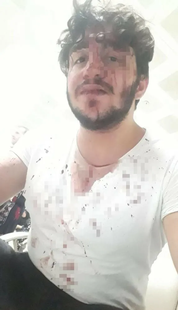 ayrildigi-takintili-kiz-arkadasi-hayatini-karartti-1626859874975.jpg Ayrıldığı takıntılı kız arkadaşı hayatını kararttı - 1