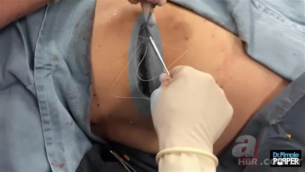 30 yıl boyunca baş ağrısıyla yaşadı! Nedeni şoke etti... 133