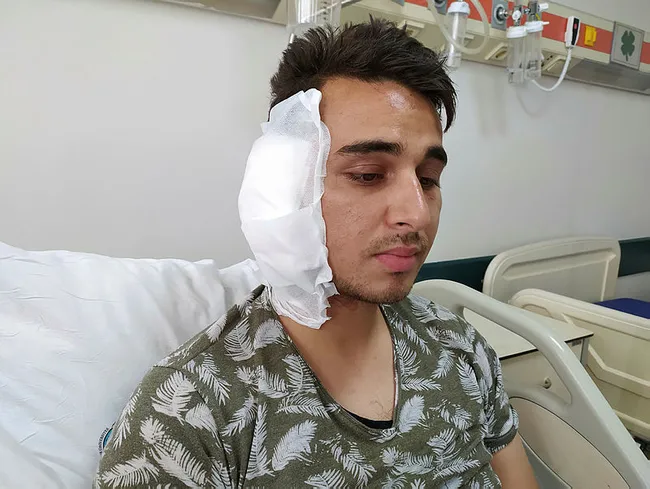 Karaman’da köpek yüzünden çıkan tartışmada postacının ısırılarak kopan kulağı yerine dikilemedi - 1