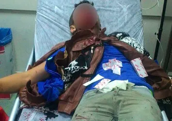 Polise atmak istediği bomba elinde patladı