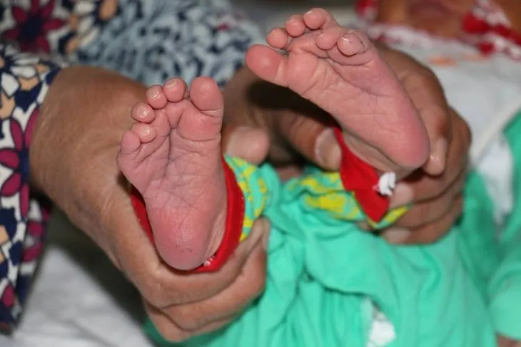 Suriyeli bebek ’24 parmaklı’ doğdu