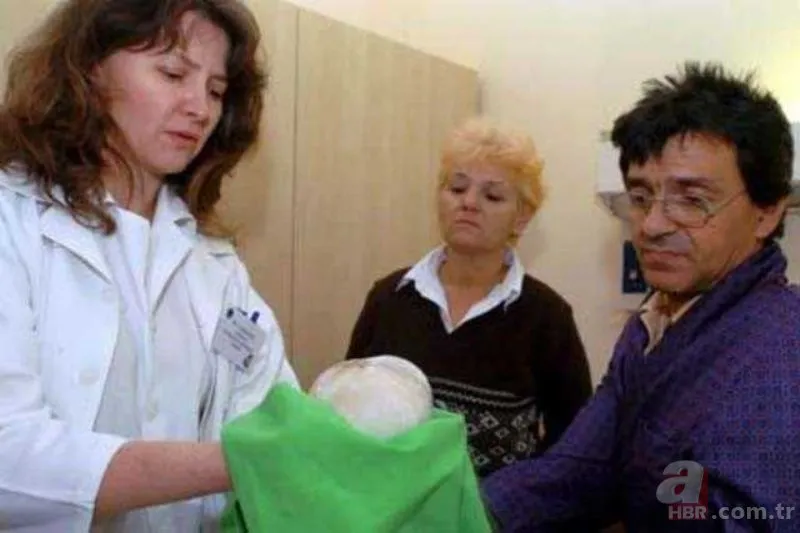 https://iaahbr.tmgrup.com.tr/f78415/0/0/0/0/0/0?u=https://iahbr.tmgrup.com.tr/album/2020/05/25/genc-kadinin-kolundan-cikanlar-soke-etti-1590417679242.jpg&l=1 https://iaahbr.tmgrup.com.tr/f78415/0/0/0/0/0/0?u=https://iahbr.tmgrup.com.tr/album/2020/05/25/genc-kadinin-kolundan-cikanlar-soke-etti-1590417679242.jpg&l=1