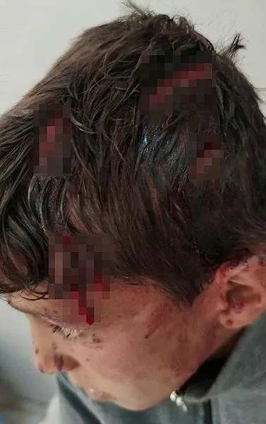 Van'da 10 yaşındaki çocuğu öldüresiye dövdüler - 3