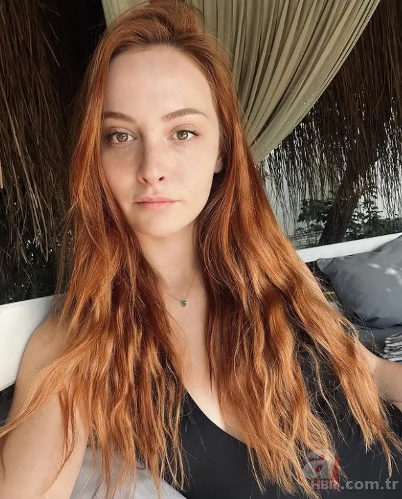 Sipahi'nin Ezgi'si Başak Gümülcinelioğlu estetik harikası çıktı! Eski halini gören şaştı kaldı 6