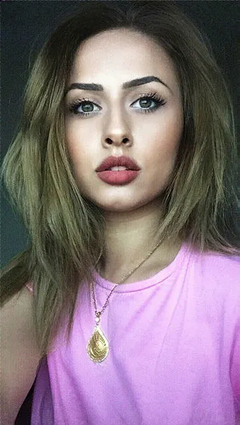 Künt kafa travması nedir? Ümitcan Uygun Esra Hankulu ölüm nedeni! Esra Hankulu neden öldü?