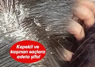 Kaşınan ve kepeklenen saçınız varsa dikkat! Bu yöntemle hem rahatlayacak hem de saçınızı uzatacaksınız