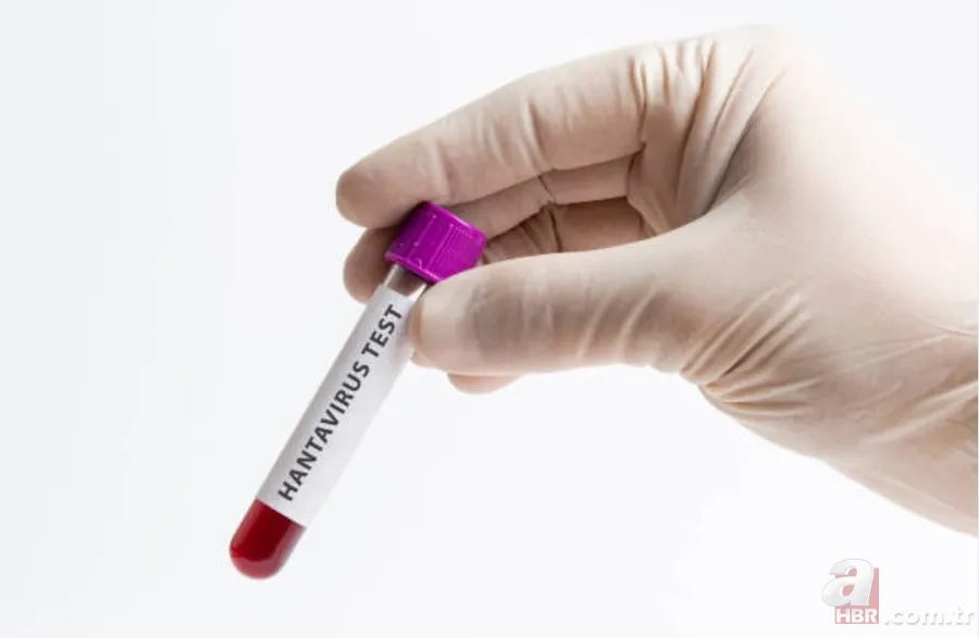 Yeni virüs mü çıktı? Hanta virüsü bulaşıcı mı? Hanta virüsü belirtileri nelerdir? Hantavirüs salgını var mı? 2