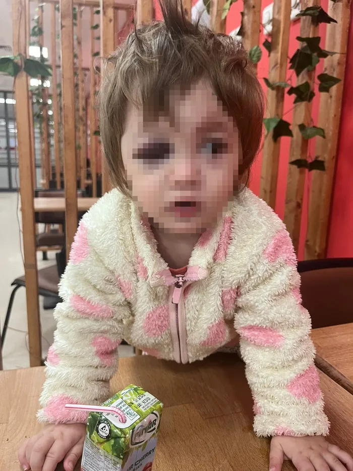 komsu-teroru-gurultu-tartismasinda-bebegin-kafatasi-catladi-1771786648600.jpg Fotoğraf-İHA