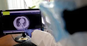 Yanlış kullanımı böbrek sağlığını tehdit ediyor