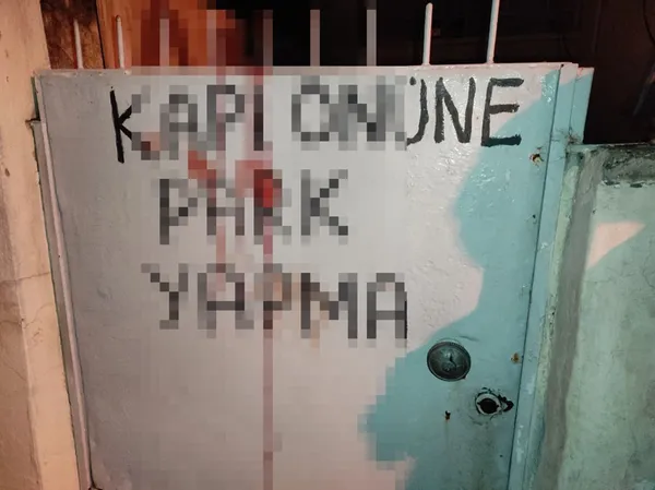 1650770174568.jpg Aydın'da korkunç olay! Bekçinin bacağına demir korkuluk saplandı - 3