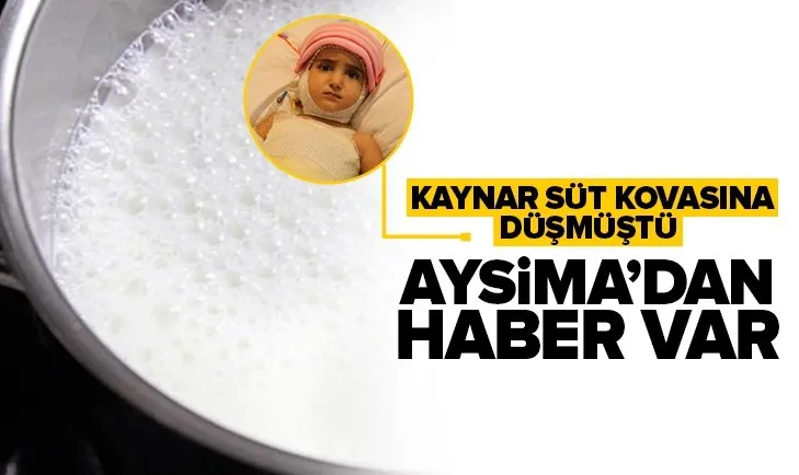 Kars’ta oyun oynarken kaynar süt kovasına düşen minik Aysima’dan haber var