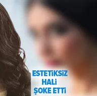 Bir Zamanlar Çukurovanın Müjganı estetiksiz haliyle şoke etti!