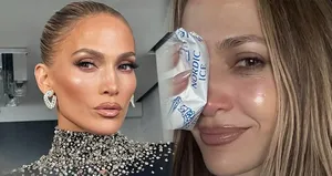 Talihsiz kaza! Sevenlerini korkuttu