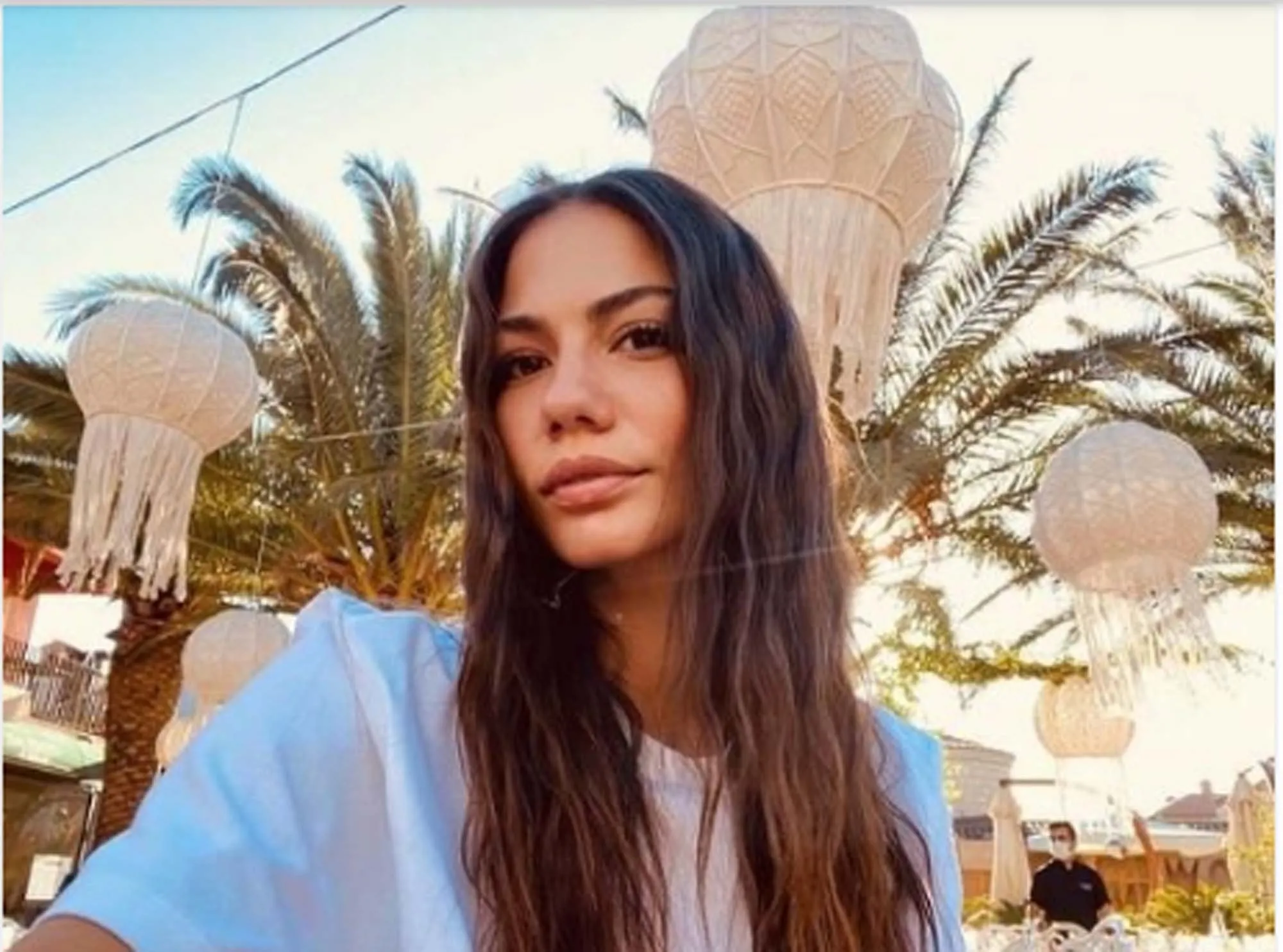 demet ozdemir in yuzune ne oldu paylasimi olay oldu