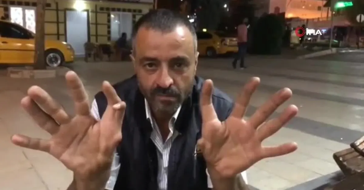 Ellerini gören hayrete düşüyor! Bu özelliği çocuklarına da geçti