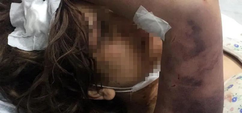 Şanlıurfa'da 3 çocuk annesine günlerce işkence yaptı