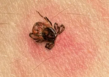 Et alerjisine yol açan kene
