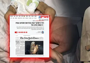 İsrail'den NYT'nin manşete taşıdığı acı fotoğrafa "pişkin" sözler! Açlık silahına "genetik hastalık" kılıfı