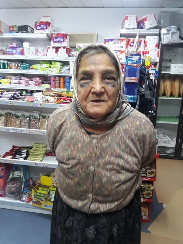 demir-cubukla-73-yasindaki-esini-canice-doven-adam-hakkinda-yasal-islem-baslatildi-1638360431476.jpg Demir çubukla 73 yaşındaki eşini canice döven adam hakkında yasal işlem başlatıldı - 1