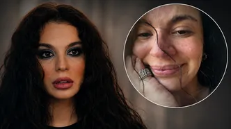 7 kez ameliyat olan Aslı Bekiroğlu sakatlandı: "Herkesin de bir sınırı var"