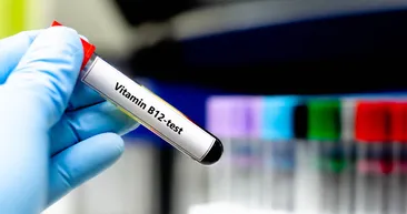 B12 değerleri tavan yapacak! Bu besini öğünlerinize mutlaka ekleyin