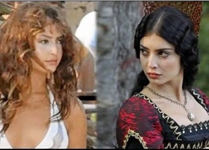 Özge Gürel�in estetiksiz hali şoke etti! Değişimi pes dedirtti