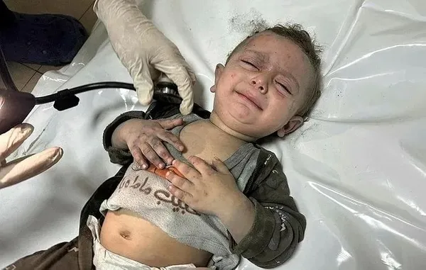 1699112210310.jpeg Katil İsrail çoluk çocuk demeden katlediyor! BM soykırımı duyurdu: Anne ve yenidoğan ölümleri artacak - 2