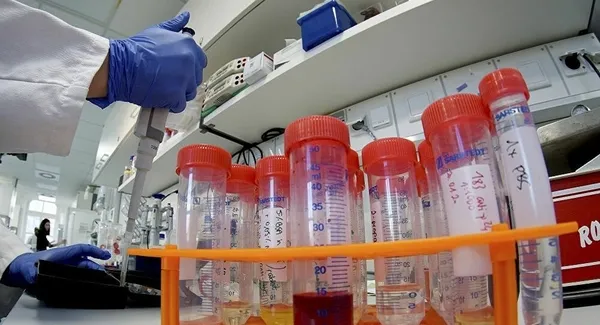 Son altı salgın Çin’de bir laboratuvardan çıktı! Dünyayı sallayacak skandal iddia!