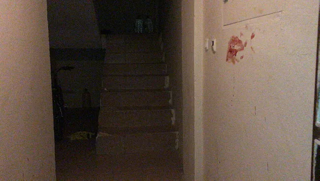 Bursa’da eski sevgilisiyle görüşen gençle karşılaştı, bıçakladı - 3