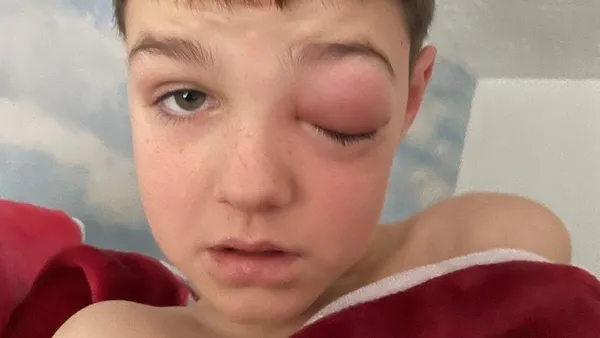 1641453881500.jpeg Koronavirüs 9 yaşındaki çocuğa kabusu yaşattı! - 1
