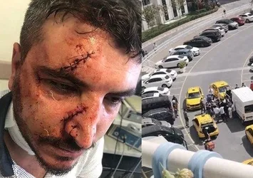 İstanbul Esenyurt'ta yol kavgası! Muşta ile saldırdı
