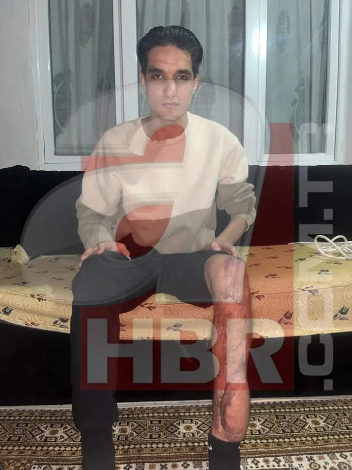 chpli-tutuncu-yine-fena-yakalandi-a-haber-tek-tek-yalanlarin-belgesini-acikliyor-1767541665254.jpg CHP Üsküdar İlçe Başkanı’nın kendisine çarpması sonucu 7 ameliyat geçiren Hacı Resul Düzgün, ilk kez ahaber.com.tr’ye konuştu.