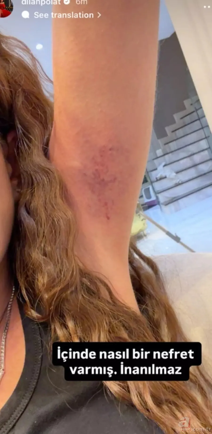 Sıla Doğu kardeşi Dilan Polat'ı fena halde dövdü! Şoke eden görüntü... 7