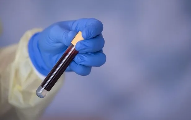 21 Eylül korona tablosu: Türkiye’de corona virüsü vaka sayısı kaç oldu? Koronadan kaç kişi öldü?