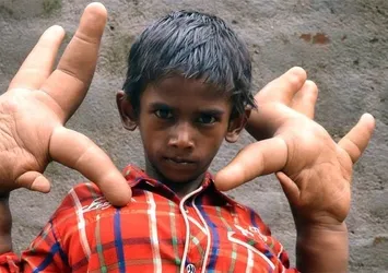 Elleri devasa boyutta!