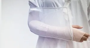 Vücuttaki kırıklar nasıl iyileşir?